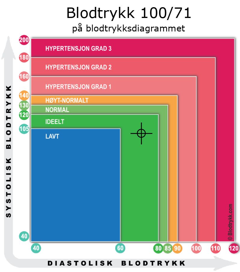 Blodtrykk 100 over 71 på blodtrykksdiagram