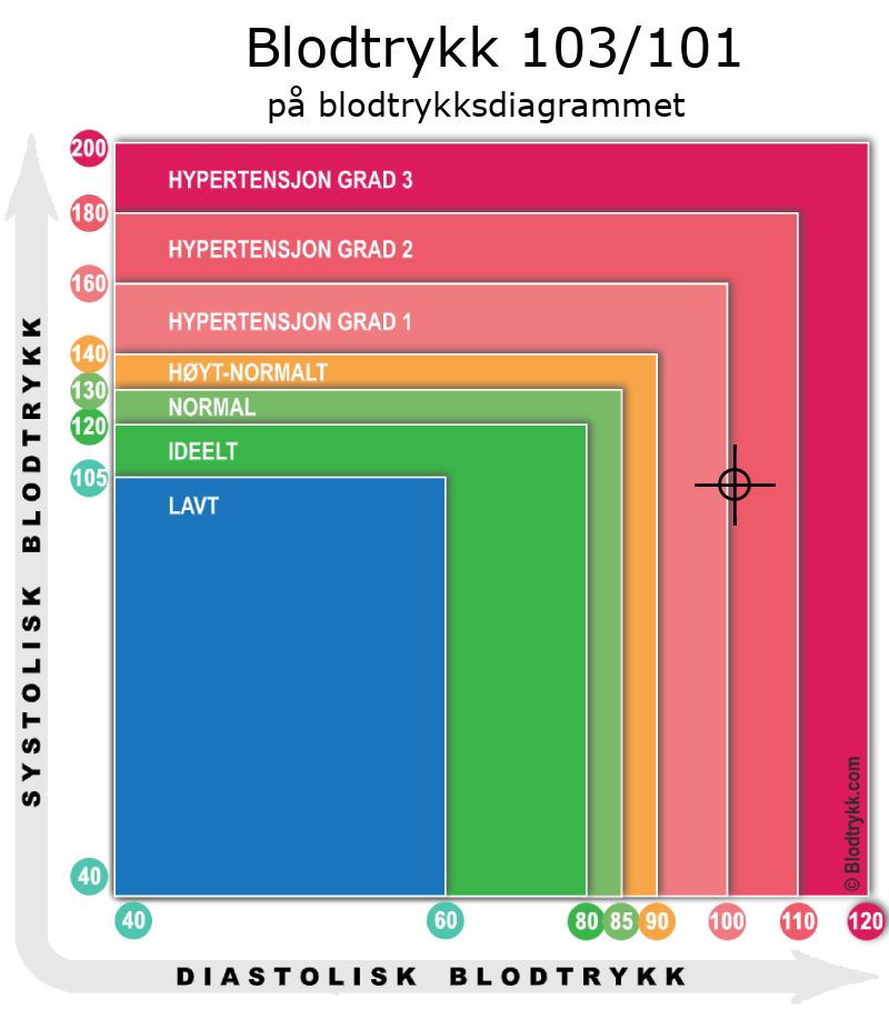 Blodtrykk 103 over 101 på blodtrykksdiagram