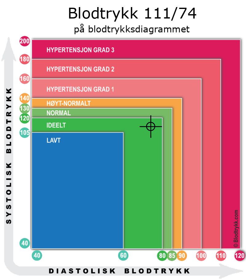 Blodtrykk 111 over 74 på blodtrykksdiagram