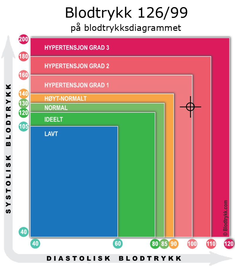 Blodtrykk 126 over 99 på blodtrykksdiagram