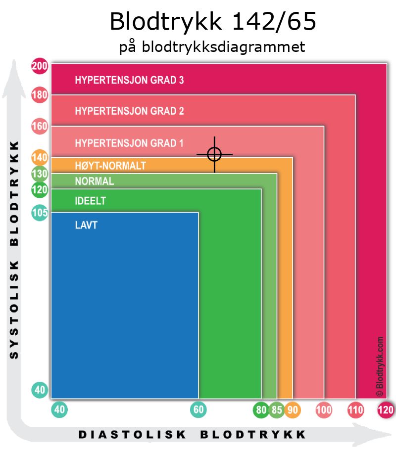Blodtrykk 142 over 65 på blodtrykksdiagram