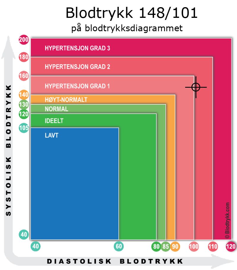 Blodtrykk 148 over 101 på blodtrykksdiagram