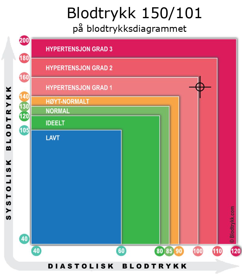 Blodtrykk 150 over 101 på blodtrykksdiagram