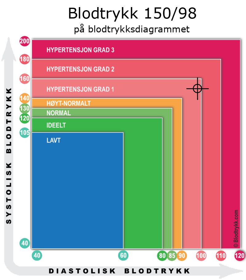 Blodtrykk 150 over 98 på blodtrykksdiagram