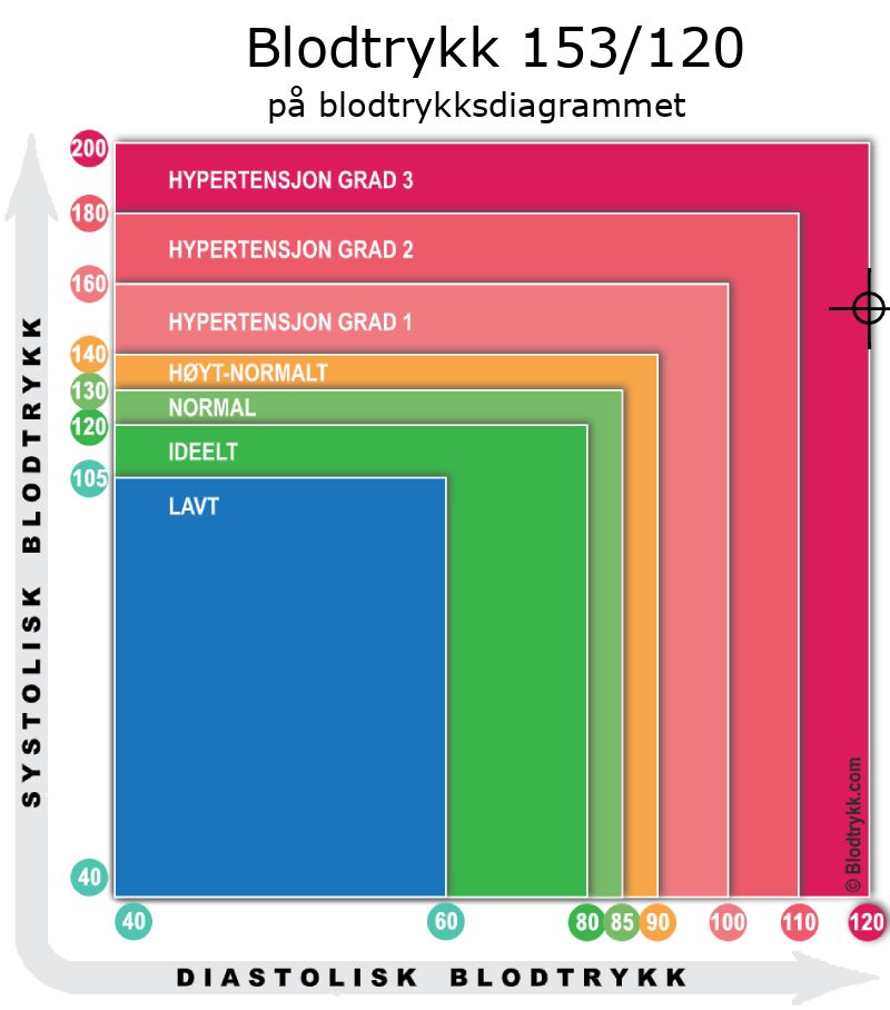 Blodtrykk 153 over 120 på blodtrykksdiagram