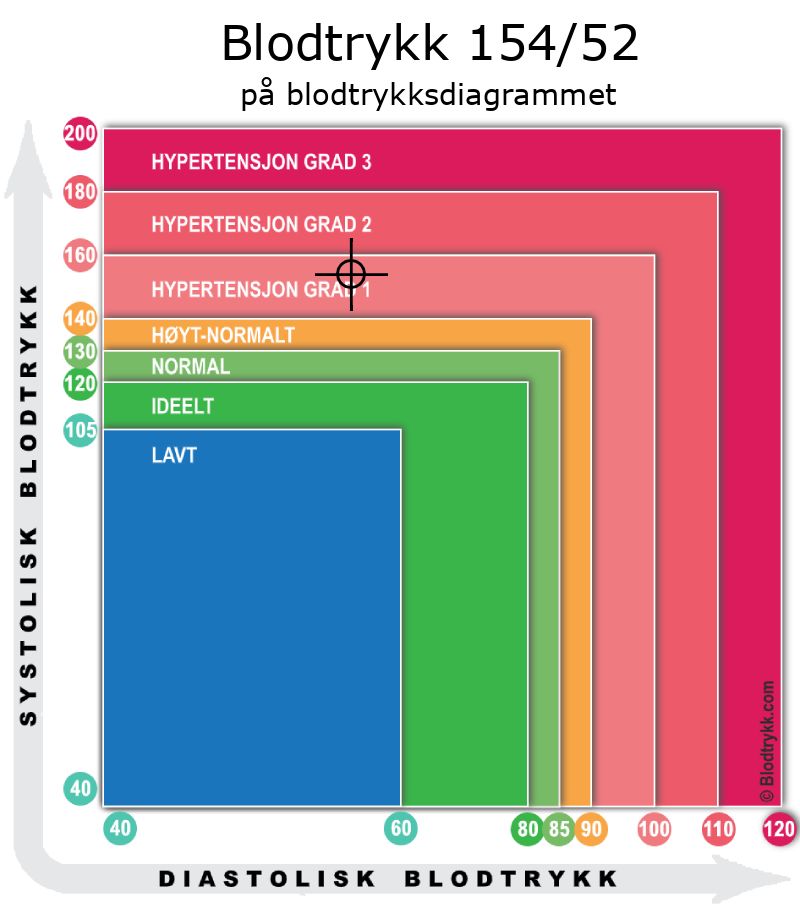 Blodtrykk 154 over 52 på blodtrykksdiagram