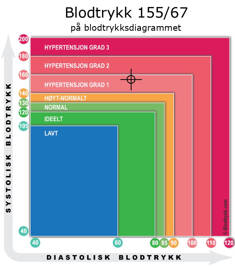 Blodtrykk 155 over 67 på blodtrykksdiagram