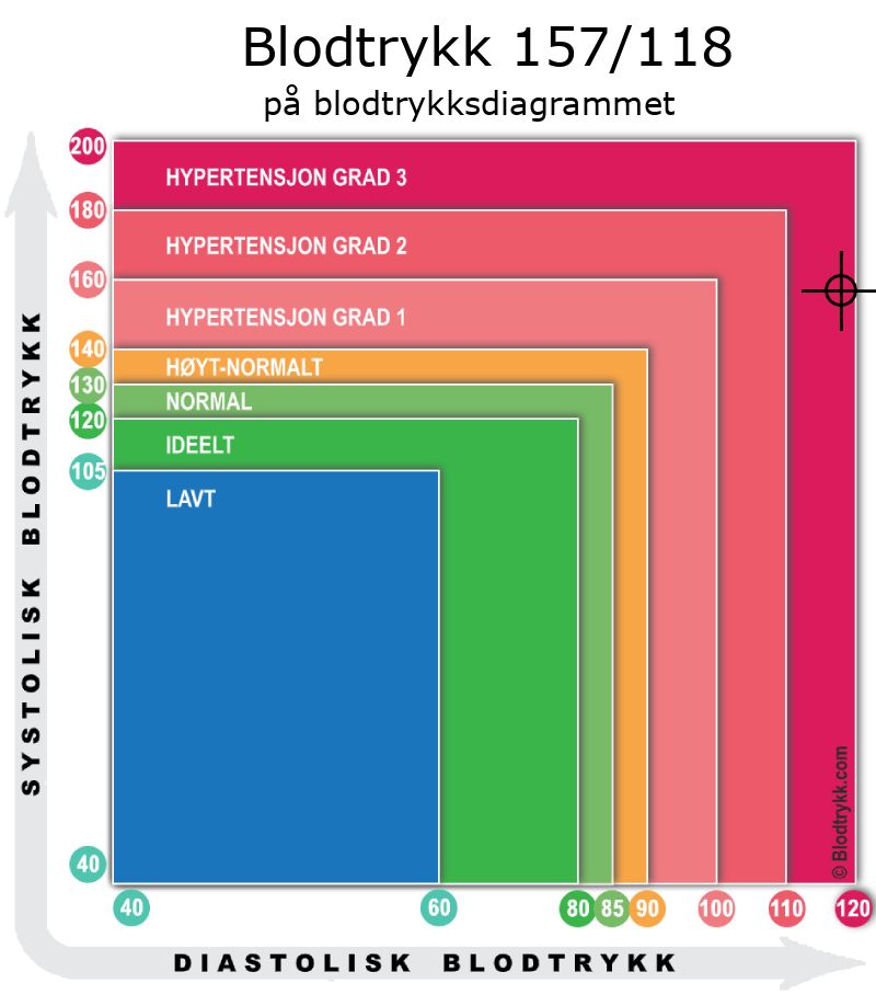 Blodtrykk 157 over 118 på blodtrykksdiagram
