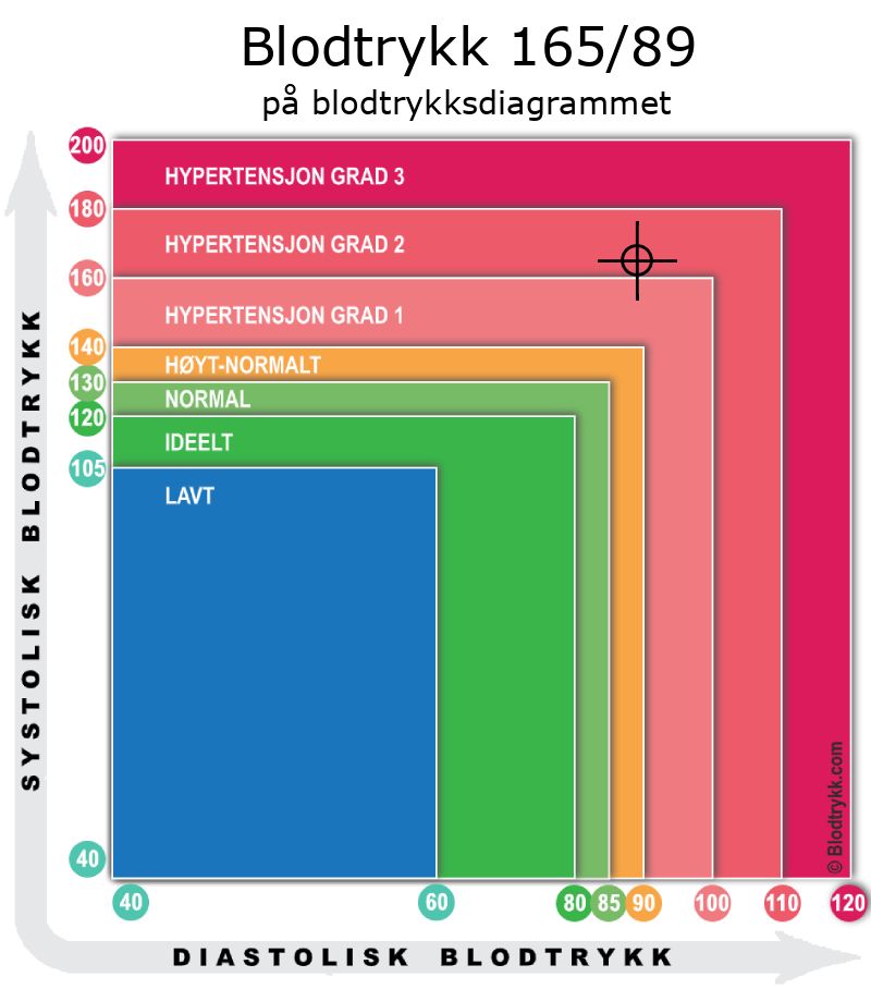 Blodtrykk 165 over 89 på blodtrykksdiagram