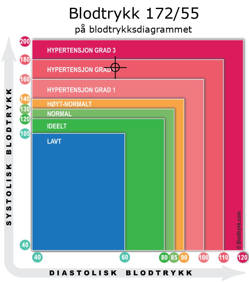 Blodtrykk 172 over 55 på blodtrykksdiagram