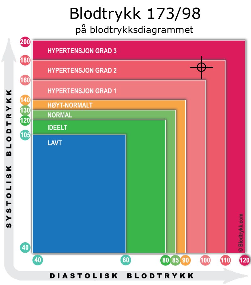 Blodtrykk 173 over 98 på blodtrykksdiagram