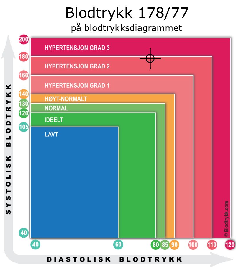 Blodtrykk 178 over 77 på blodtrykksdiagram