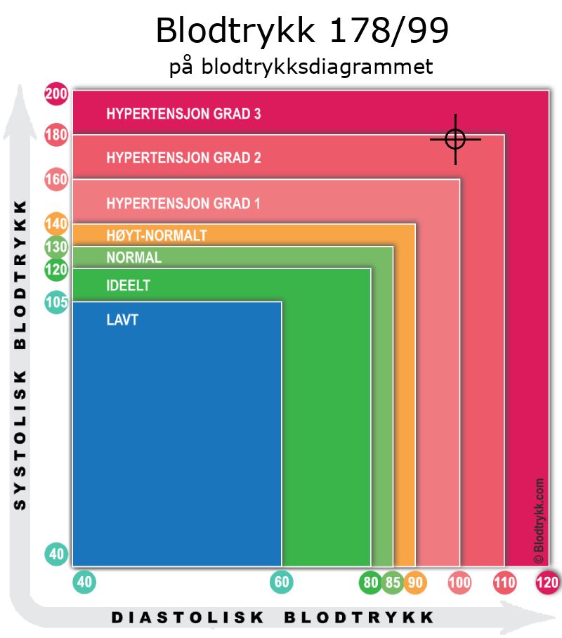 Blodtrykk 178 over 99 på blodtrykksdiagram