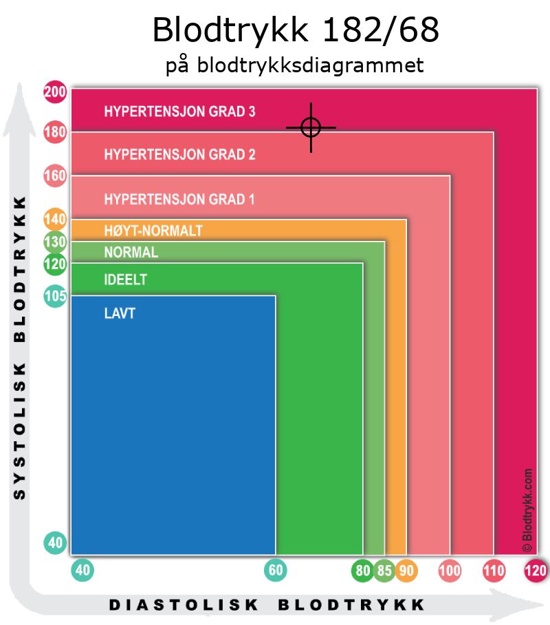 Blodtrykk 182 over 68 på blodtrykksdiagram