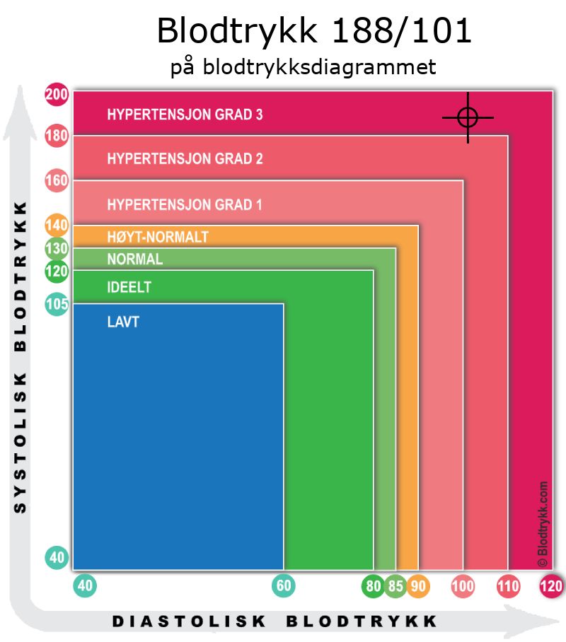 Blodtrykk 188 over 101 på blodtrykksdiagram