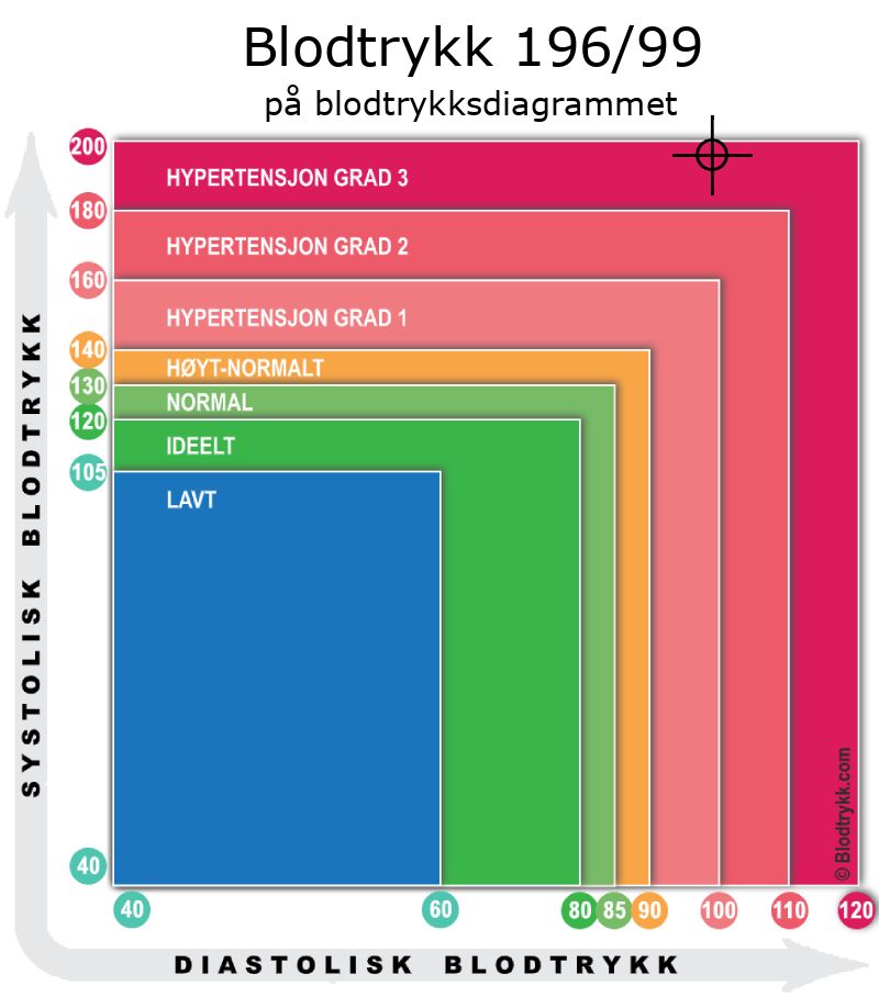Blodtrykk 196 over 99 på blodtrykksdiagram