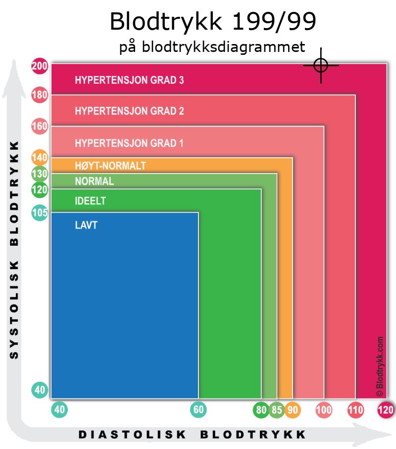 Blodtrykk 199 over 99 på blodtrykksdiagram