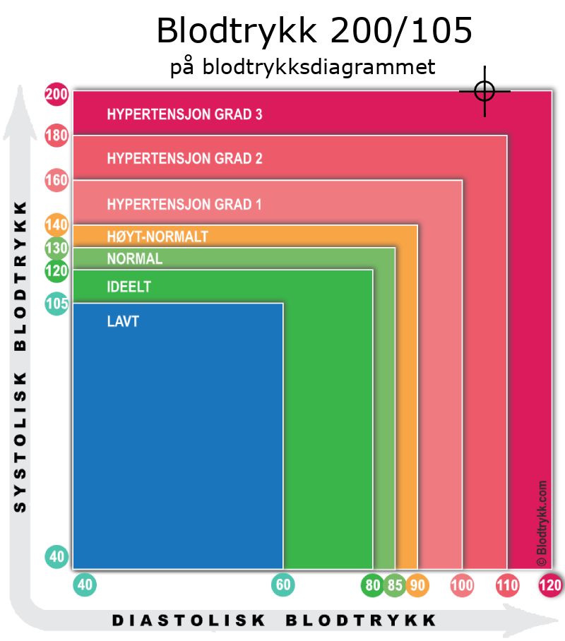 Blodtrykk 200 over 105 på blodtrykksdiagram