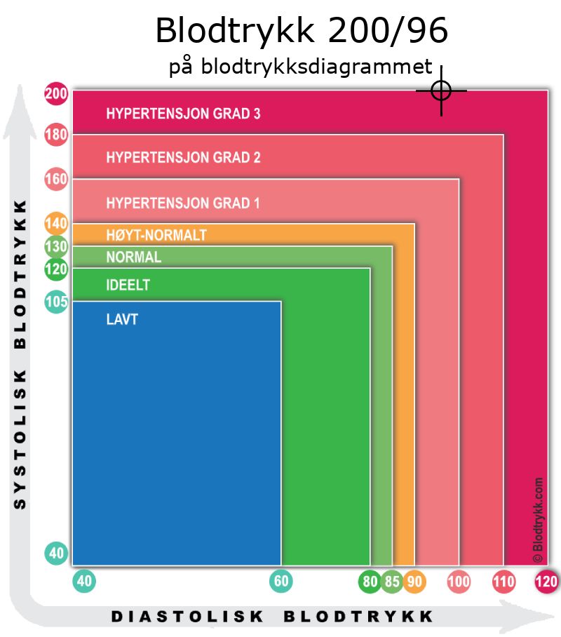 Blodtrykk 200 over 96 på blodtrykksdiagram