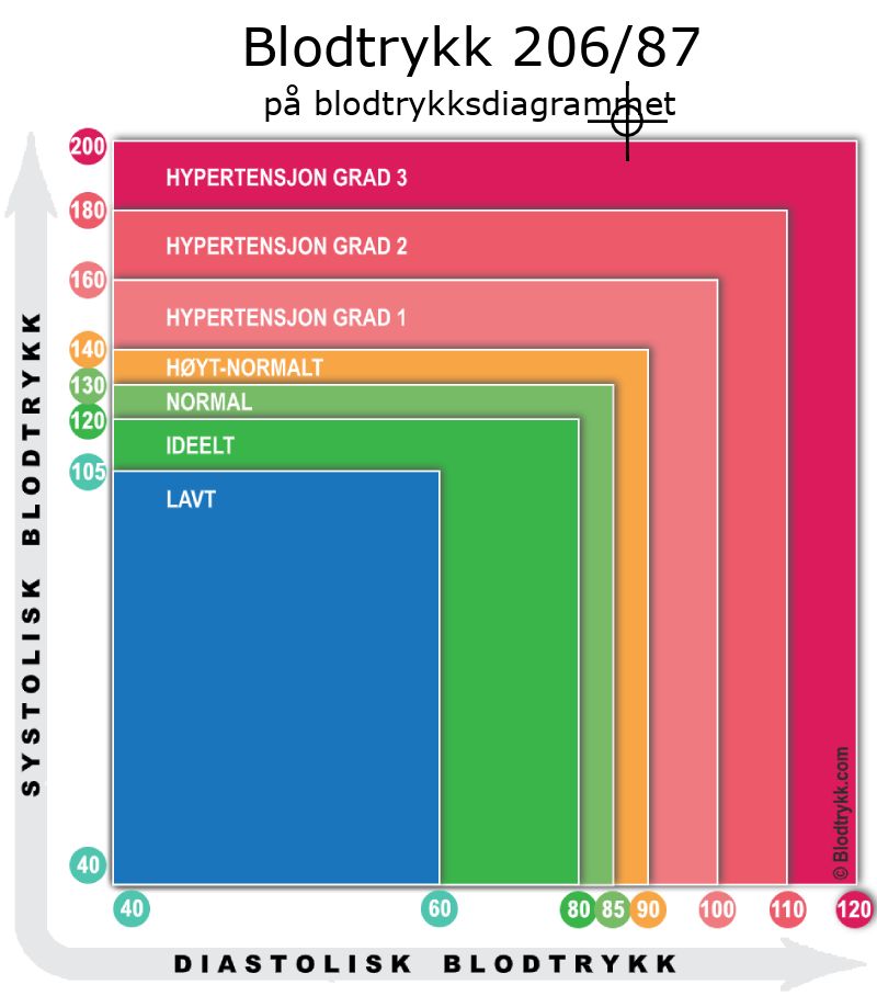 Blodtrykk 206 over 87 på blodtrykksdiagram