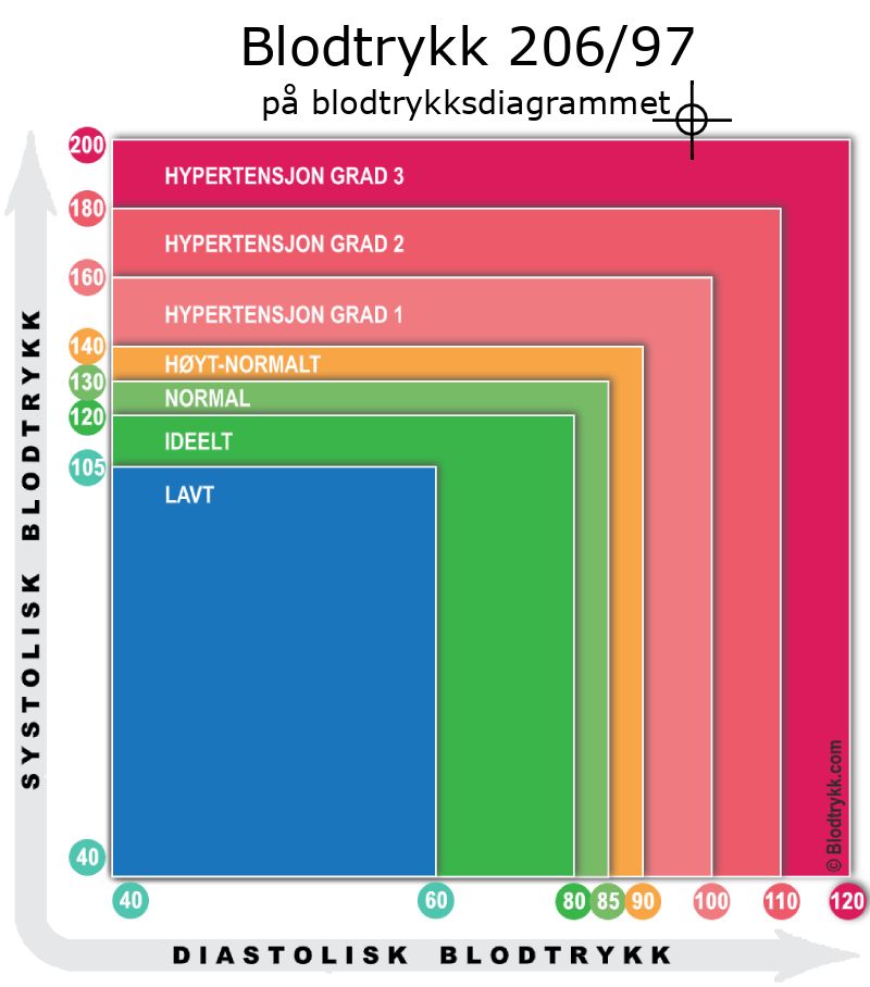 Blodtrykk 206 over 97 på blodtrykksdiagram