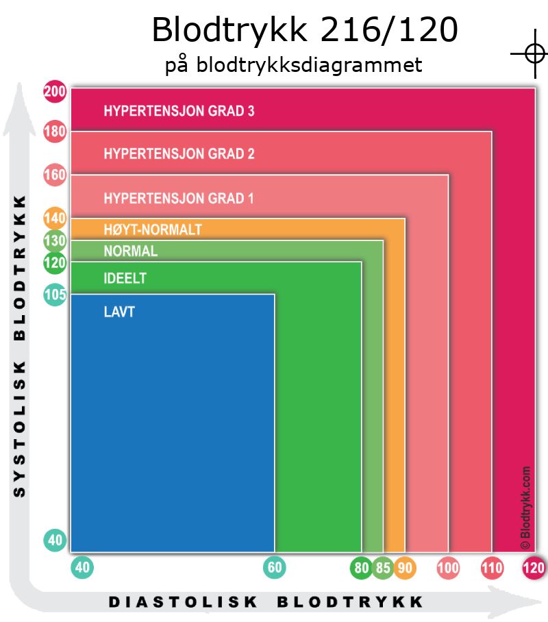 Blodtrykk 216 over 120 på blodtrykksdiagram