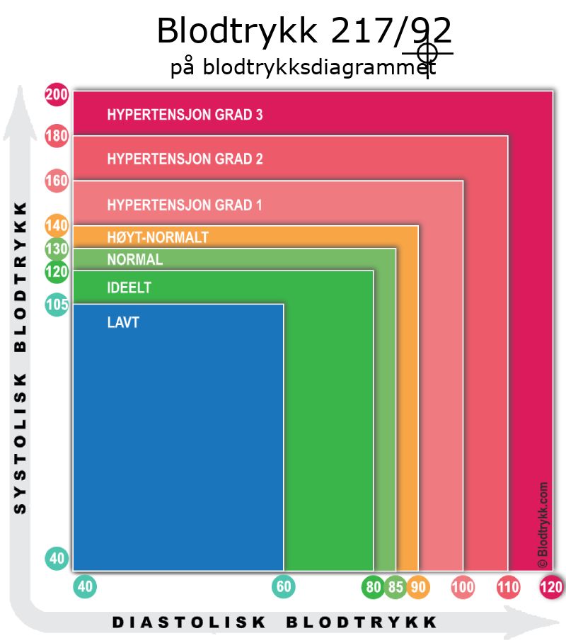Blodtrykk 217 over 92 på blodtrykksdiagram