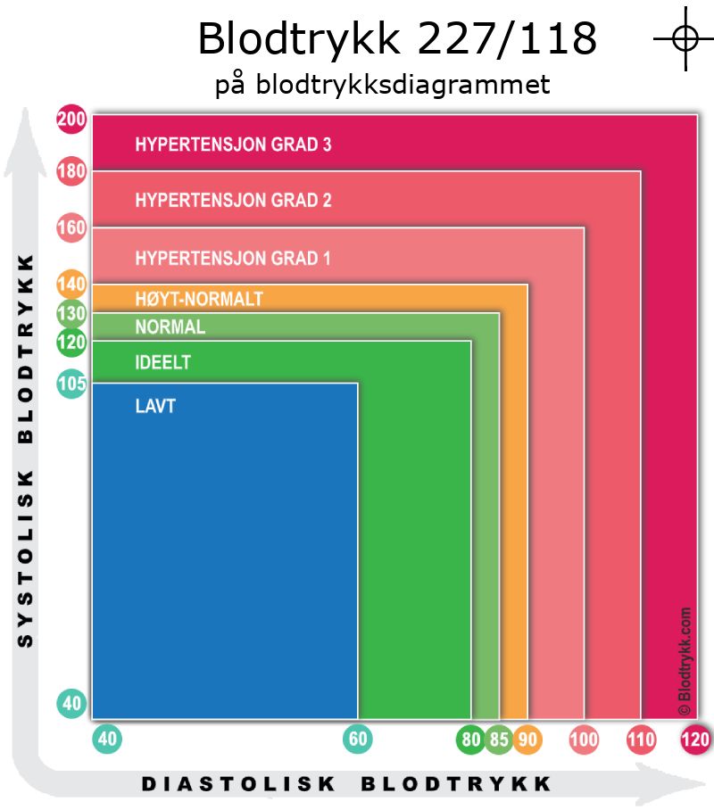 Blodtrykk 227 over 118 på blodtrykksdiagram