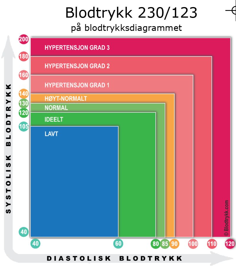 Blodtrykk 230 over 123 på blodtrykksdiagram