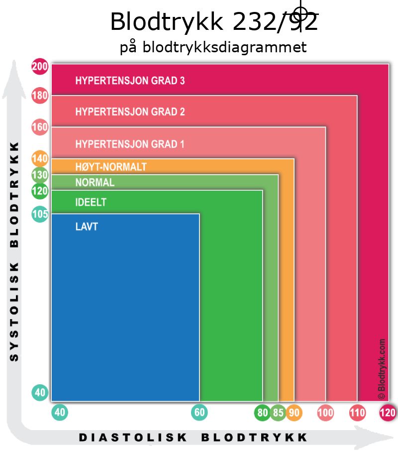 Blodtrykk 232 over 92 på blodtrykksdiagram