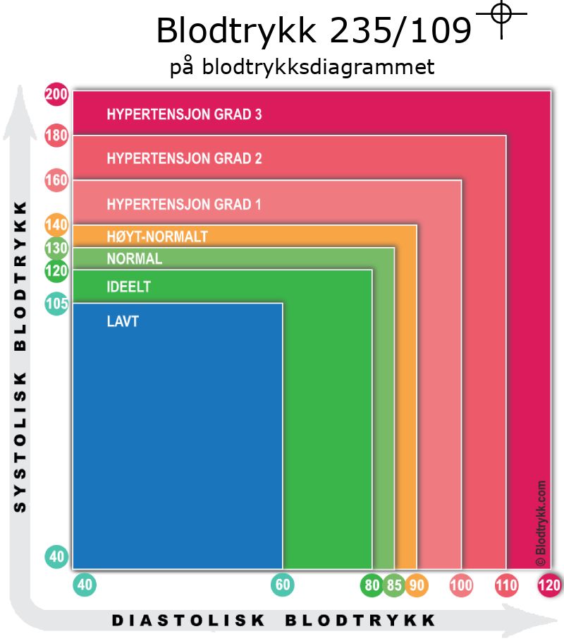 Blodtrykk 235 over 109 på blodtrykksdiagram