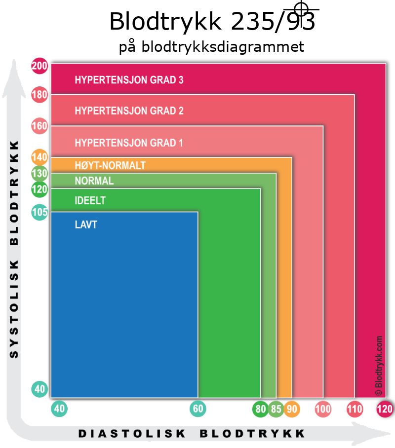 Blodtrykk 235 over 93 på blodtrykksdiagram