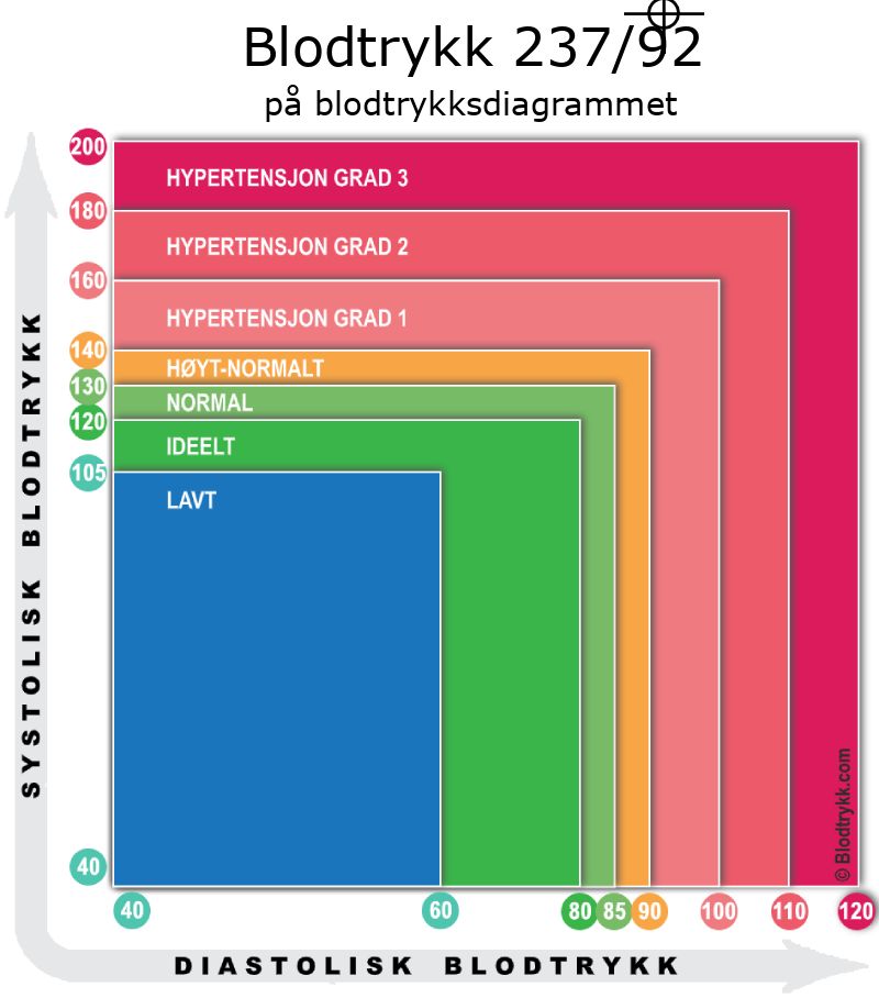 Blodtrykk 237 over 92 på blodtrykksdiagram