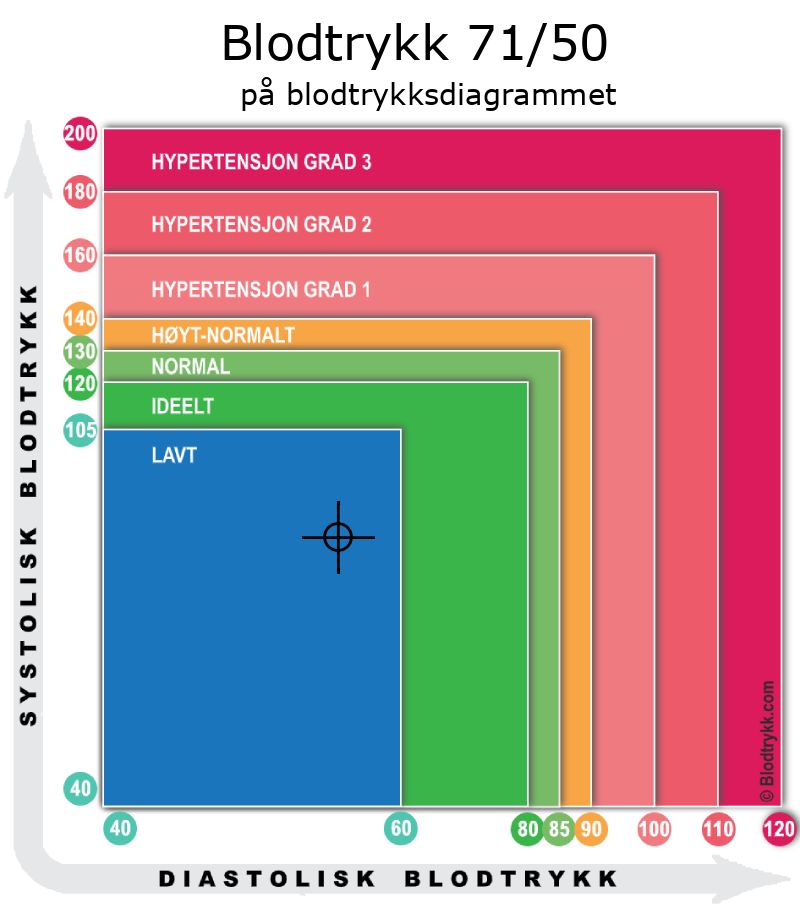 Blodtrykk 71 over 50 på blodtrykksdiagram