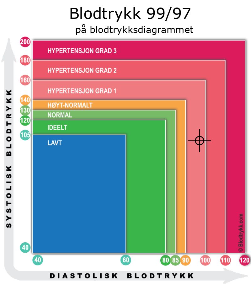 Blodtrykk 99 over 97 på blodtrykksdiagram